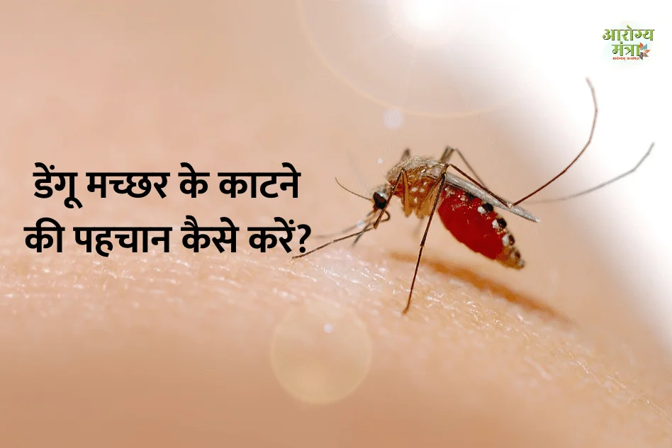 how-to-identify-dengue-mosquito-bite